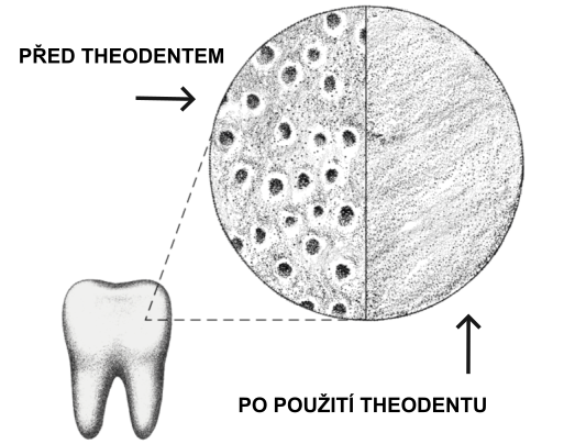 před a po theodentu